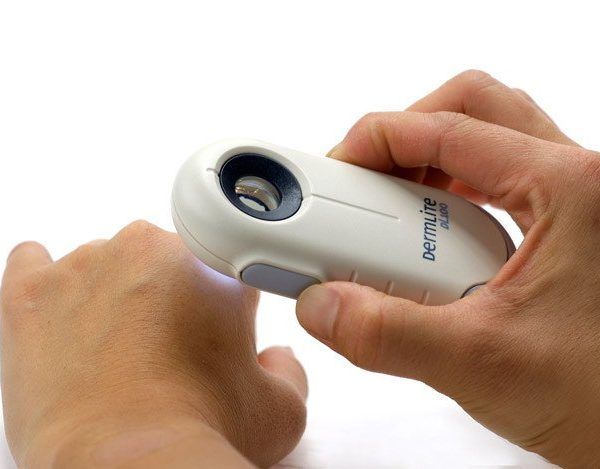 Dermatoscopio DermLite DL100 Luz Polarizada 3Gen